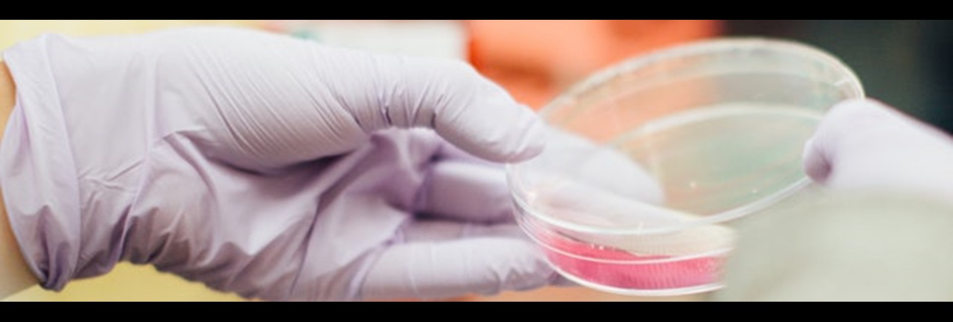 El método empleado permite a Ingenasa desarrollar los tests sin tener en el laboratorio presencia del coronavirus